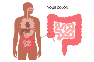 Colonoscopy Colon