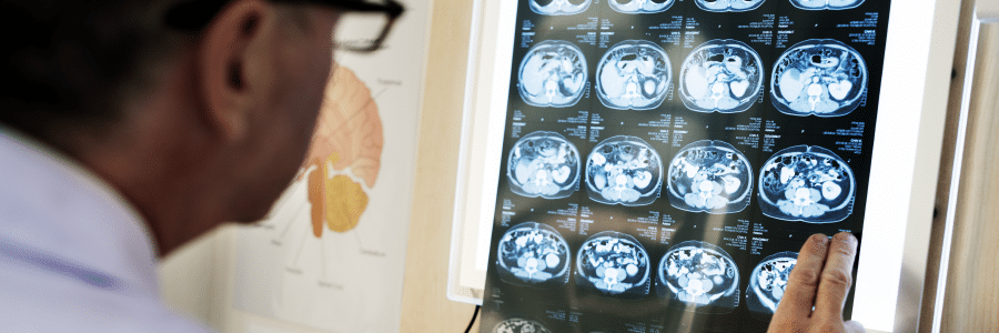 Doctors reviewing brain scans